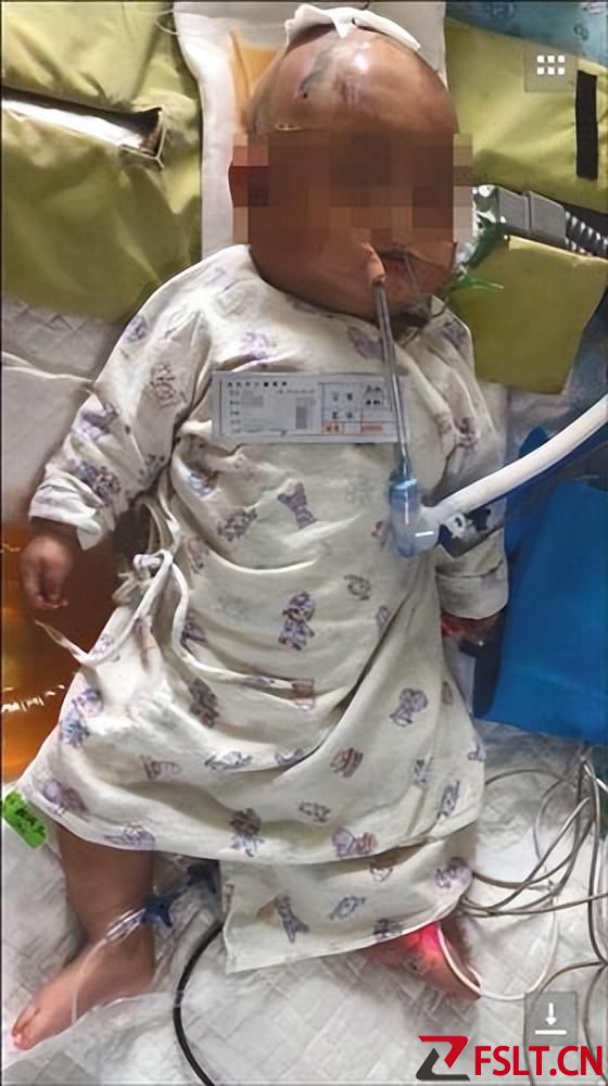 2018年，廣東三個(gè)月大女?huà)氡惶O(píng)果砸傷，警方提取全樓DNA揪出真兇